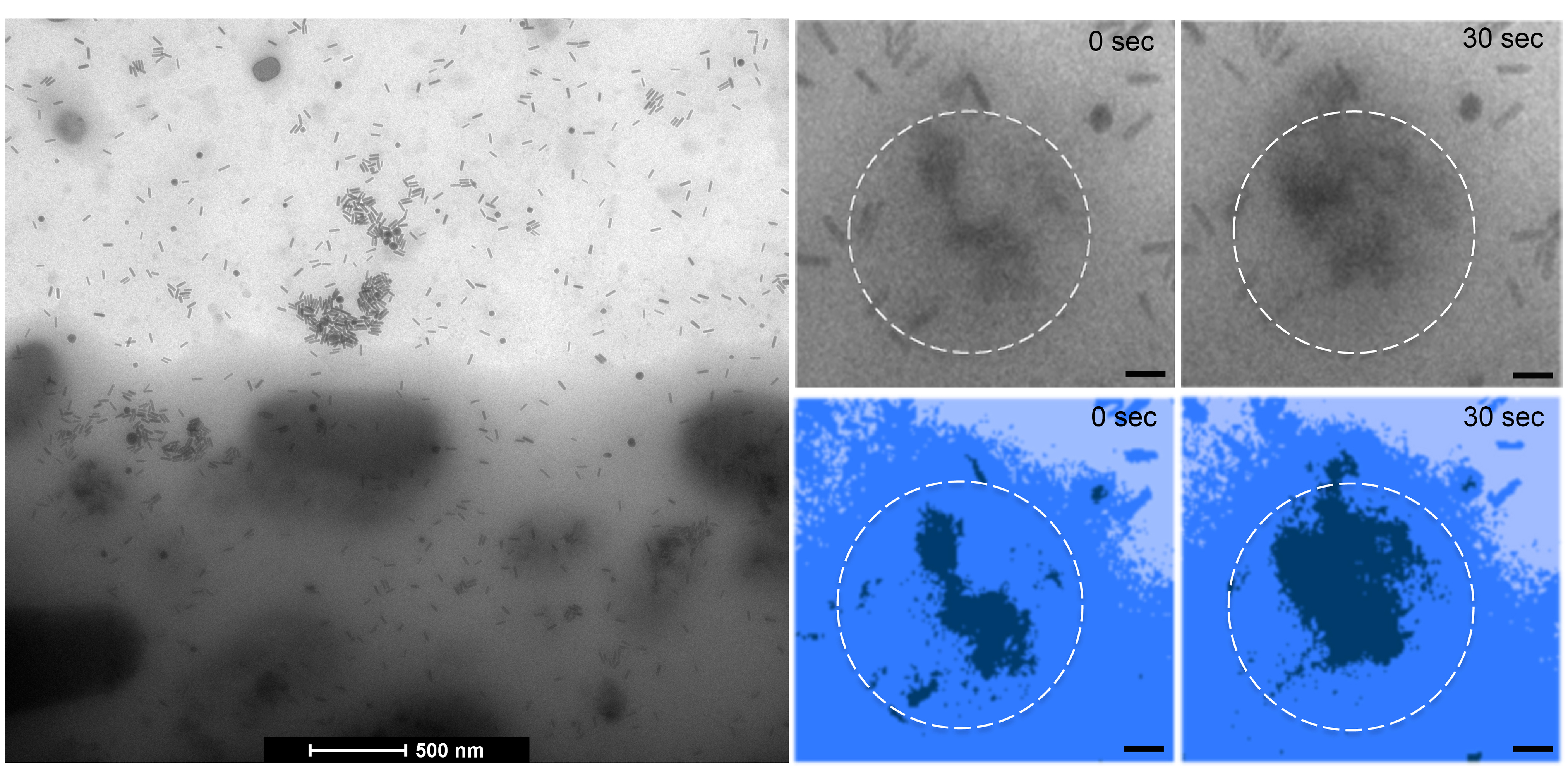Scientists developed new imaging techniques to see how brain cancer cells (the darker grey on the bottom left) take in gold nano bar treatment (the small grey specks). The blown up images on the right show how the cell takes up the treatment over 30 seconds.