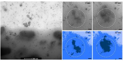 Scientists developed new imaging techniques to see how brain cancer cells (the darker grey on the bottom left) take in gold nano bar treatment (the small grey specks). The blown up images on the right show how the cell takes up the treatment over 30 seconds. 
