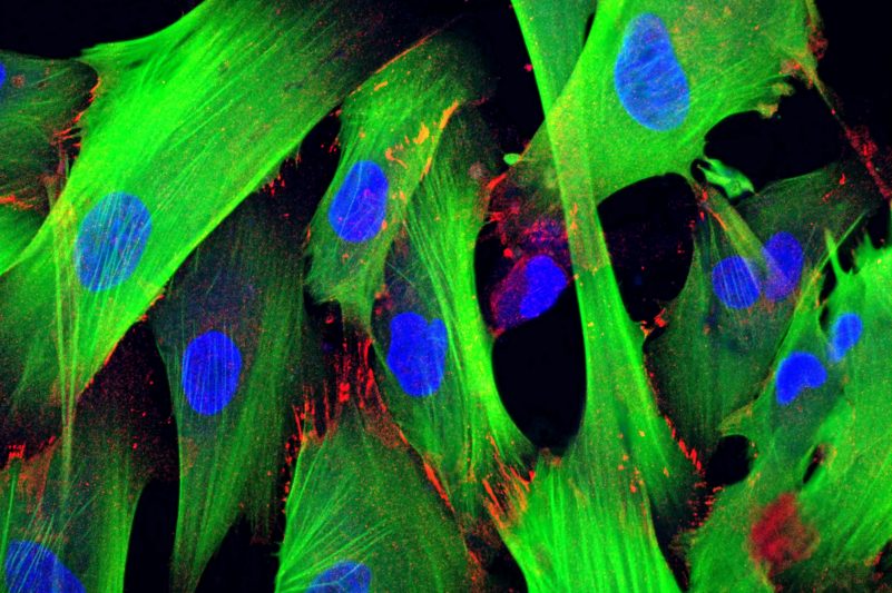 fibroblast microscope image