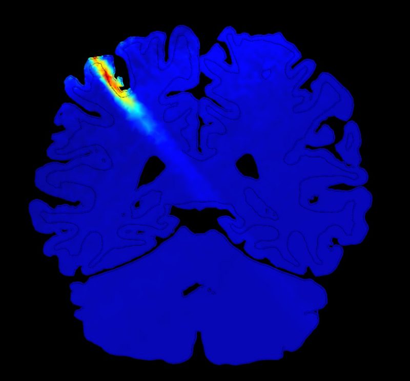 Image of brain ultrasound