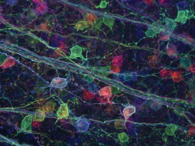 colorfully tagged retinal ganglion cells of a rodent brain