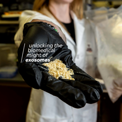 ‘Milestone’ discovery may unlock the true biomedical might of exosomes