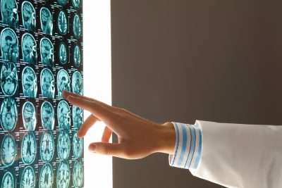 Researcher Pointing to Brain Scans